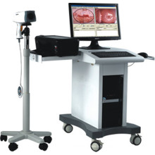 POY2200 Colposcope Digital Imaging System (numérique)